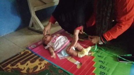 Thumbnail artikel Darurat Stunting di Karawang Sebabkan Bayi Meninggal